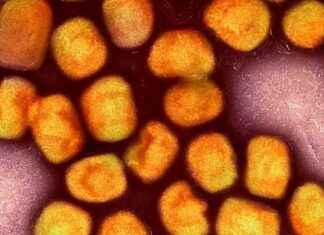 WHO warnt vor Mpox-Virus-Ausbruch: Höchste Alarmstufe erreicht news-14082024-214626