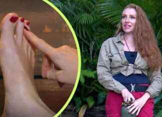 Georgina gesteht Beauty-OP im Dschungelcamp news-26082024-121239