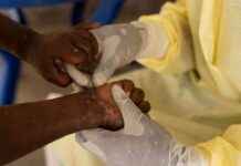 Auswirkungen und Prävention von Mpox in Afrika news-18102024-102940